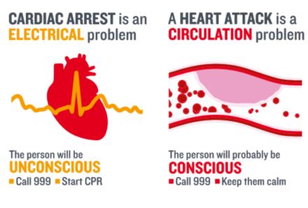 Qual è la differenza tra arresto cardiaco ed infarto? La guida del British Heart Foundation